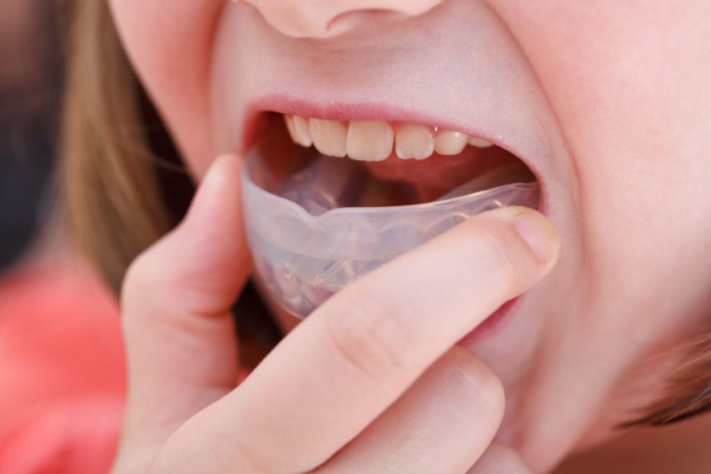 Child with mouthguard 